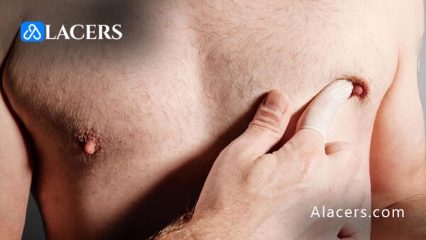 can men get breast cancer
